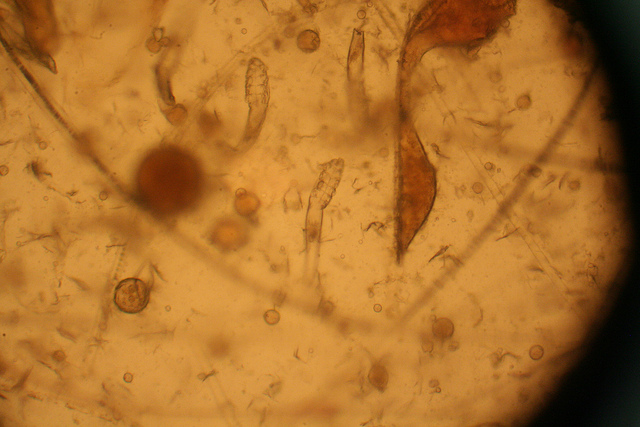 Подкожный клещ в объективе микроскопа