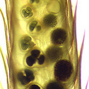 Микроспория в микроскопии