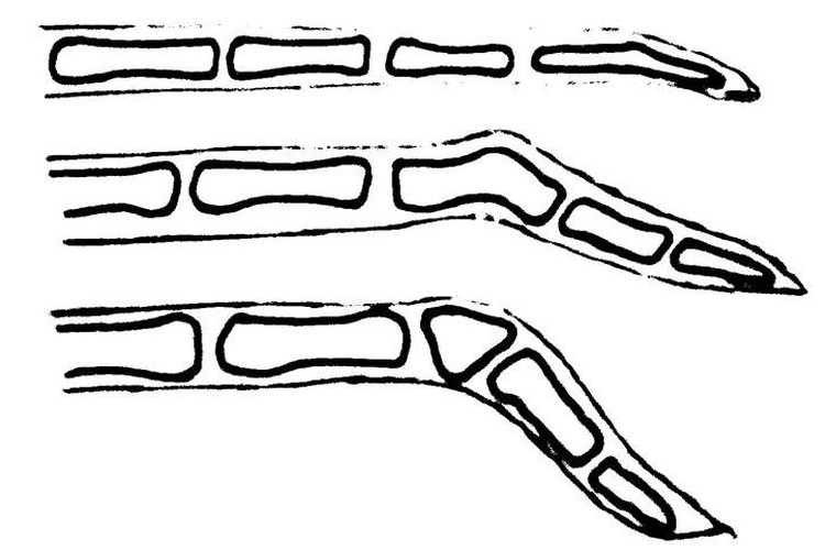 Схематическое изображение переломов хвоста