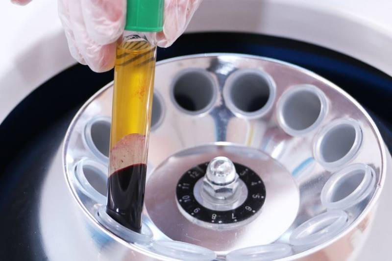 Коэффициент ритиса у кошек понижен: что это, лечение, симптомы